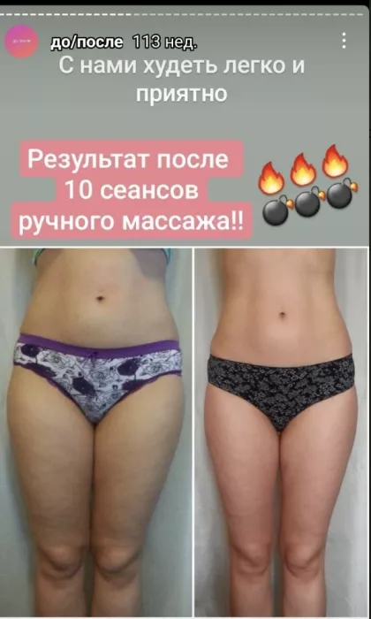 Студия коррекции фигуры Fat Away 
