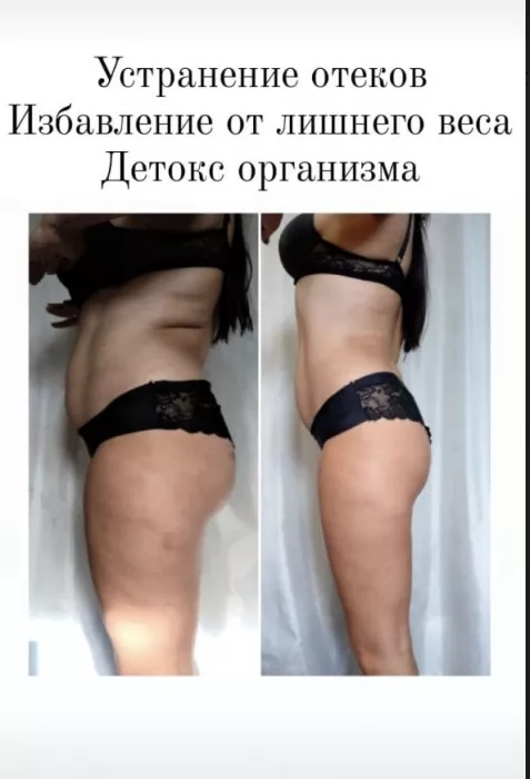 Студия коррекции фигуры Fat Away 