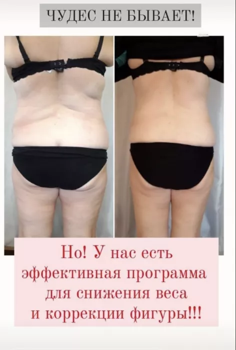 Студия коррекции фигуры Fat Away 