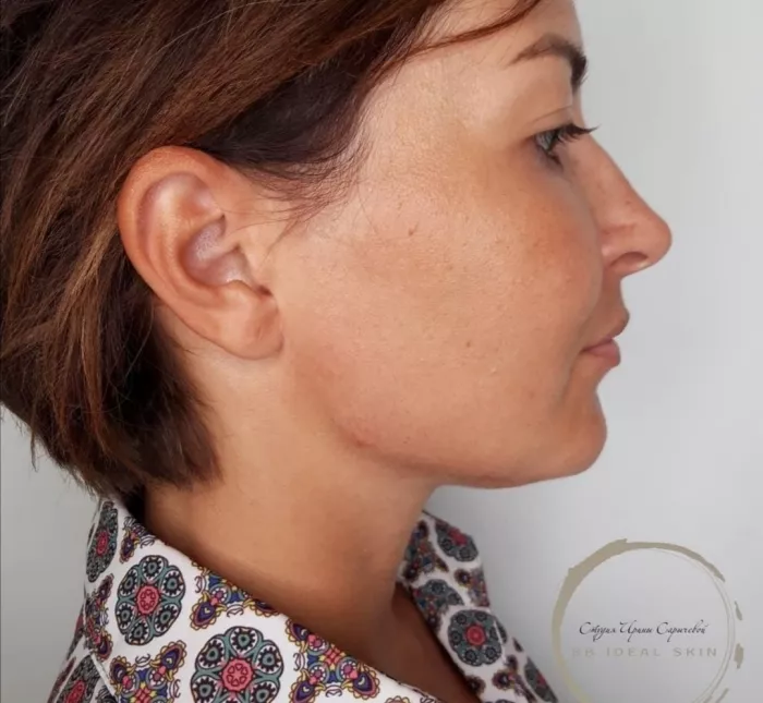 Салон красоты "Bb Ideal Skin"