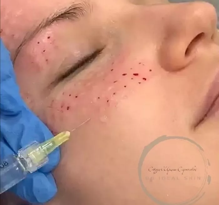 Салон красоты "Bb Ideal Skin"