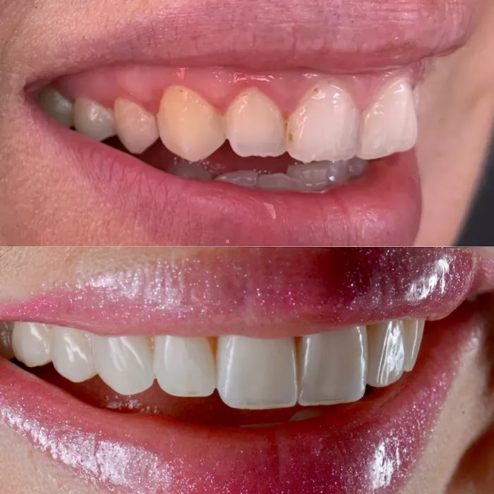 Стоматологическая клиника "DentAntalya (Oral & Dental Health Clinic)"