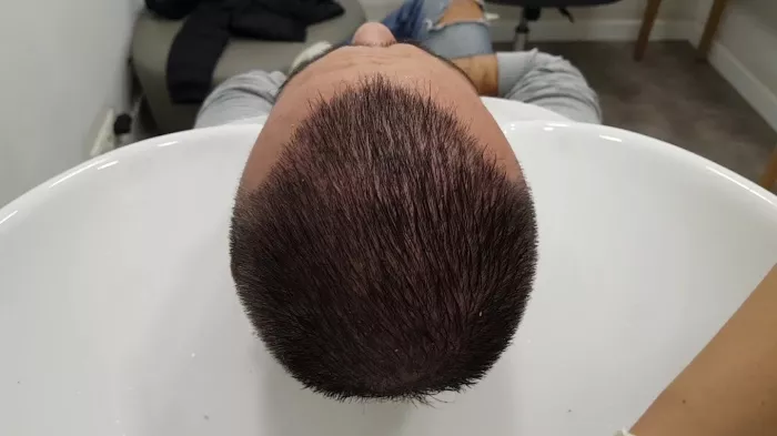 Дерматолог "DK Klinik (Dermatology and Hair Transplant Antalya)"