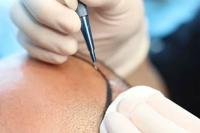 Клиника пересадки волос "SE Hair Clinic | Hair Transplant"