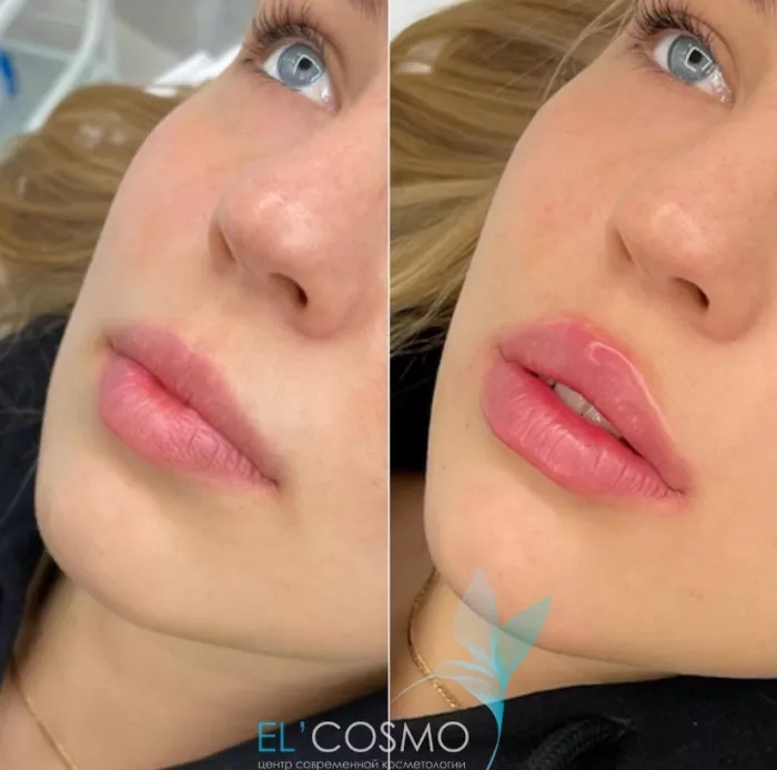 Центр современной косметологии Оксаны Самойловой "El`cosmo".