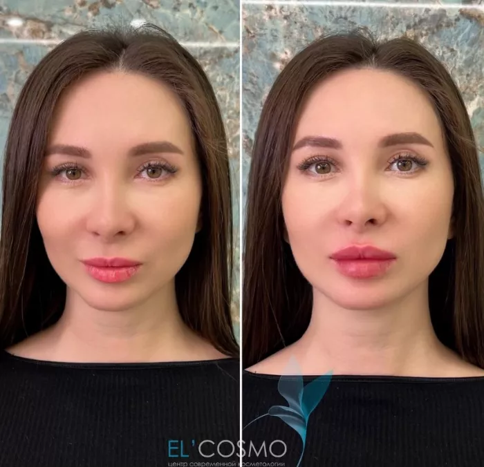 Центр современной косметологии Оксаны Самойловой "El`cosmo".