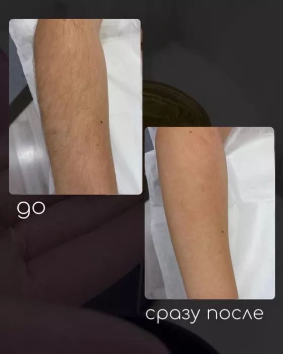 Центр шугаринга "SUGARING CENTER".