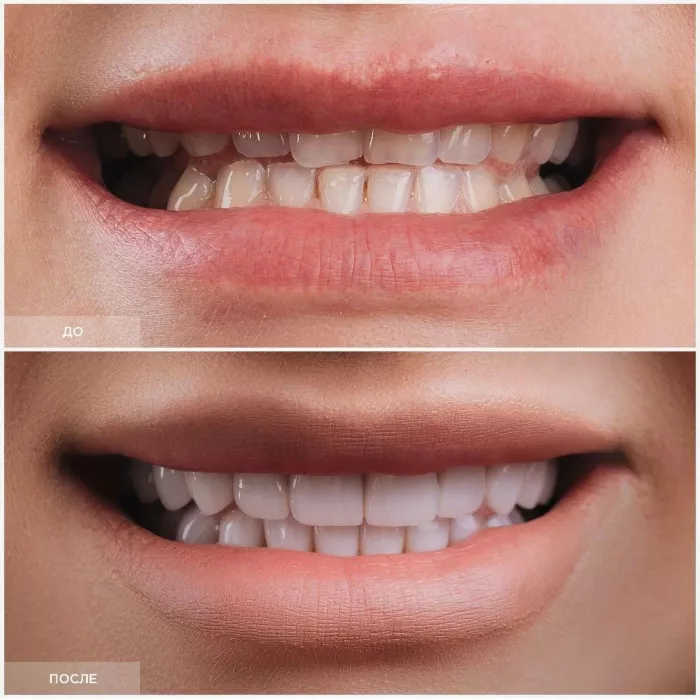 Стоматологическая клиника - Dental Lounge "InWhite".