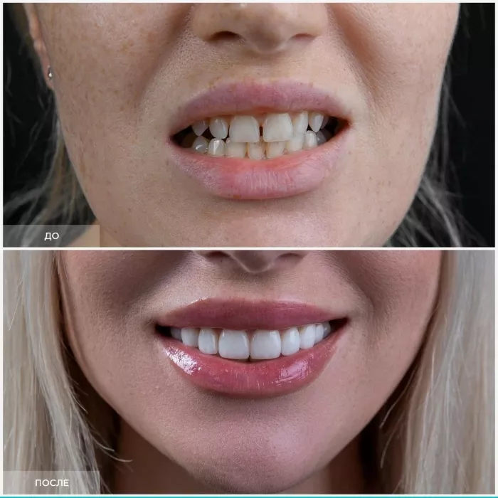 Стоматологическая клиника - Dental Lounge "InWhite".