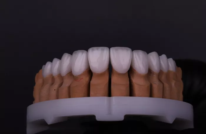 Стоматологическая клиника "Digital Implant clinic"
