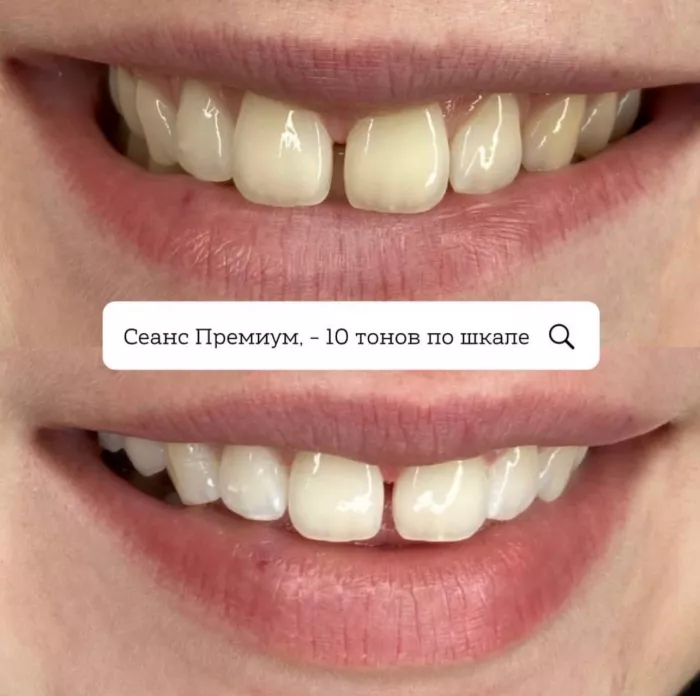 Студия отбеливания зубов "White & Smile".