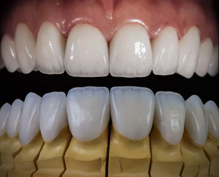 Стоматологическая клиника "ULTRADENT"