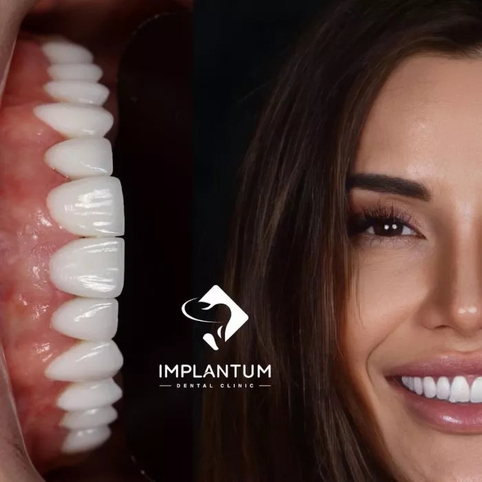 Стоматологическая клиника "IMPLANTUM"