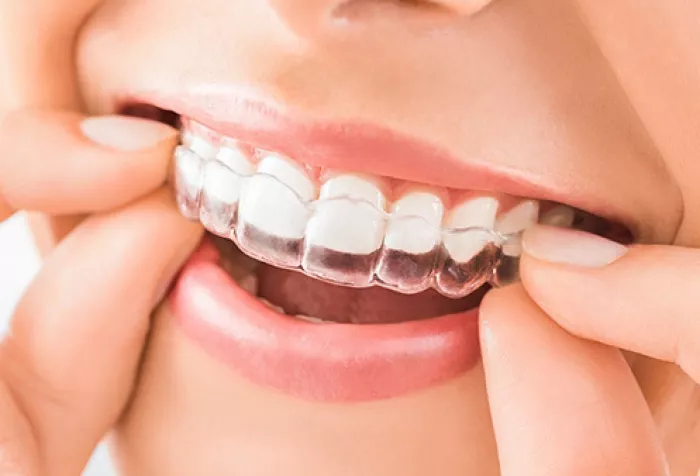 Стоматологическая клиника «Ilham Dental Clinic»