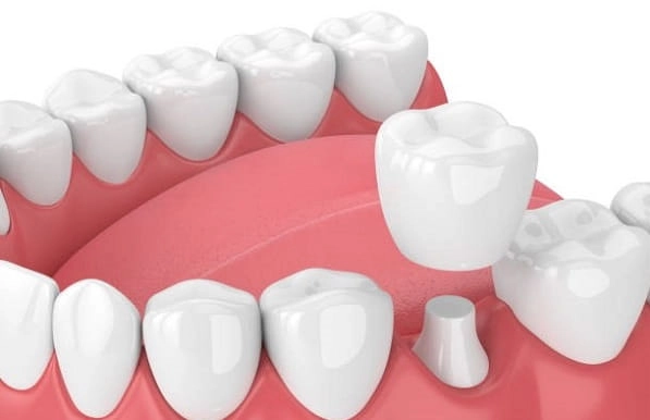 Стоматологическая клиника «Ilham Dental Clinic»